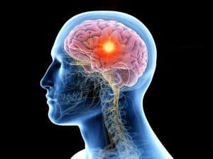 What Is “Brain Death”?