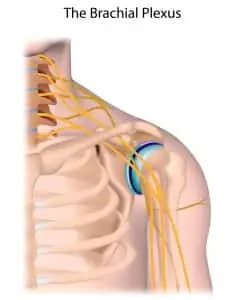 What Are Brachial Plexus Injuries?